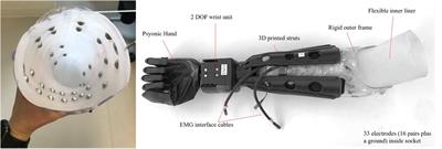 Implications of EMG channel count: enhancing pattern recognition online prosthetic testing